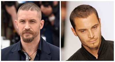 Hairstyles for Balding Men: 11 Best Advices - EnkiVeryWell Hairstyles for Balding Men: 11 Best Advices - EnkiVeryWell